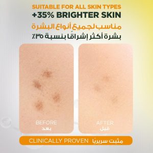 ⁦Garnier Fast Bright 30x Vitamin C Anti Dark Spot Serum 30ml⁩ - الصورة ⁦5⁩