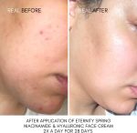 ⁦Nut Botanicals Eternity Spring Niacinamide And Hyaluronic Face Cream 120 Ml⁩ - الصورة ⁦2⁩