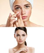 ⁦ACM Laboratoire dermatologique Sebionex trio anti-imperfections cream 40ml⁩ - الصورة ⁦5⁩