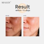 ⁦So Sandy Shine & White Face Serum - Bee Venom Serum⁩ - الصورة ⁦6⁩