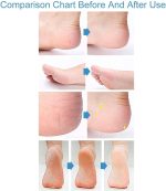 ⁦Panasonic ER240BP Beard Trimmer, Battery Operated - Black - Made in Japan – International Warranty⁩ - الصورة ⁦7⁩