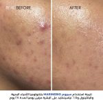 ⁦Nut Botanicals Marinebio 5% Niacinamide Serum With Panthenol B5 & Postbiotic Complex 30 Ml⁩ - الصورة ⁦4⁩
