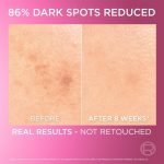 ⁦L’Oréal Paris L'Oréal Paris Glycolic Bright Glowing Serum 30ml⁩ - الصورة ⁦4⁩