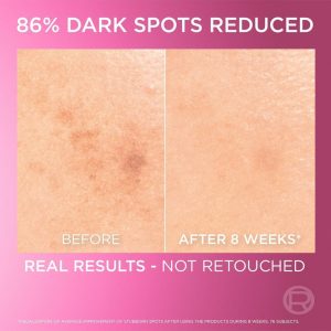 ⁦L’Oréal Paris L'Oréal Paris Glycolic Bright Glowing Serum 30ml⁩ - الصورة ⁦4⁩