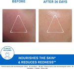 ⁦كريم الوجه زيموز من يورياج - 40 مل⁩ - الصورة ⁦5⁩