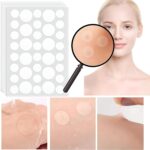 ⁦رقعة علاج حب الشباب 💛❇️ نضعها على البثور لمدة 8 ساعات لتجفيفها بشكل فعال ❤️ تمتص البكتيريا الموجودة في البثور بسرعة وتمنع الندبات ❤️ تبقى ثابتة حتى مع التعرض للماء. (48 لصقه)⁩ - الصورة ⁦3⁩
