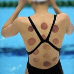 ⁦أكواب حجامة، علاج حجامة صيني تقليدي بكؤوس مغناطيسية حيوية، مجموعة كؤوس حجامة بالشفط لتخفيف الألم، تقليل دهون الدم وتحسين الدورة الدموية والعلاج بالمنعكسات والوخز بالإبر من زوزي، (مجموعة من 12 كوب)⁩ - الصورة ⁦5⁩