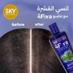 ⁦شامبو من سكاي للشعر الدهني، مضاد للقشرة والحكة مع التحكم بالزيوت والعناية بفروة الرأس، علاج ثيرابيوتك مرطب، عبوة واحدة سعة 400 مليلتر⁩ - الصورة ⁦4⁩