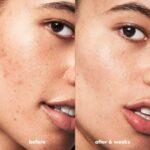 ⁦e.l.f. SKIN Blemish Breakthrough Blemish Fighting Spot Gel, Roll-on Blemish Spot Gel For Targeting & Treating Blemishes, Infused With Salicylic Acid⁩ - الصورة ⁦4⁩